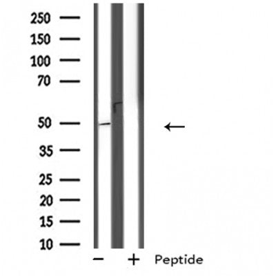 DF4897 staining Hela by IF/ICC. The sample were fixed with PFA and permeabilized in 0.1% Triton X-100,then blocked in 10% serum for 45 minutes at 25¡ãC. The primary antibody was diluted at 1/200 and incubated with the sample for 1 hour at 37¡ãC. An  Alexa Fluor 594 conjugated goat anti-rabbit IgG (H+L) Ab, diluted at 1/600, was used as the secondary antibod
