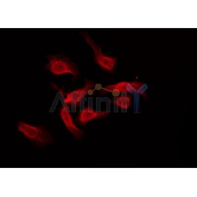Western blot analysis of extracts from Mouse  muscle, using GPR18 Antibody. The lane on the left was treated with blocking peptide.