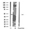 DF4907 staining HepG2 by IF/ICC. The sample were fixed with PFA and permeabilized in 0.1% Triton X-100,then blocked in 10% serum for 45 minutes at 25¡ãC. The primary antibody was diluted at 1/200 and incubated with the sample for 1 hour at 37¡ãC. An  Alexa Fluor 594 conjugated goat anti-rabbit IgG (H+L) Ab, diluted at 1/600, was used as the secondary antibod