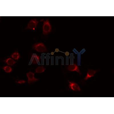 DF4911 staining Hela by IF/ICC. The samples were fixed with PFA and permeabilized in 0.1% Triton X-100,then blocked in 10% serum for 45 minutes at 25¡ãC. Samples were then incubated with primary Ab(DF4911 1:200) and mouse anti-beta tubulin Ab(T0023 1:200) for 1 hour at 37¡ãC. An  AlexaFluor594 conjugated goat anti-rabbit IgG(H+L) Ab(S0006 Red 1:600) and an AlexaFluor488 conjugated goat anti-mouse IgG(H+L) Ab(S0017 Green 1:600) were used as the secondary antibod