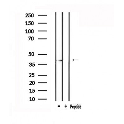 Western blot analysis of extracts from 293, using CCKAR Antibody.