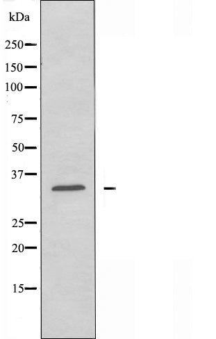 DF4917 staining COLO205 by IF/ICC. The sample were fixed with PFA and permeabilized in 0.1% Triton X-100,then blocked in 10% serum for 45 minutes at 25¡ãC. The primary antibody was diluted at 1/200 and incubated with the sample for 1 hour at 37¡ãC. An  Alexa Fluor 594 conjugated goat anti-rabbit IgG (H+L) Ab, diluted at 1/600, was used as the secondary antibod
