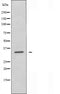 DF4917 staining COLO205 by IF/ICC. The sample were fixed with PFA and permeabilized in 0.1% Triton X-100,then blocked in 10% serum for 45 minutes at 25¡ãC. The primary antibody was diluted at 1/200 and incubated with the sample for 1 hour at 37¡ãC. An  Alexa Fluor 594 conjugated goat anti-rabbit IgG (H+L) Ab, diluted at 1/600, was used as the secondary antibod