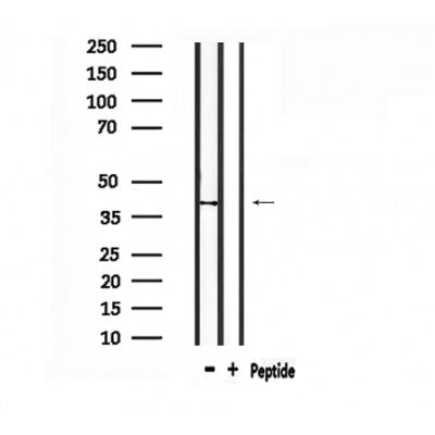 DF4921 staining COLO205 by IF/ICC. The sample were fixed with PFA and permeabilized in 0.1% Triton X-100,then blocked in 10% serum for 45 minutes at 25¡ãC. The primary antibody was diluted at 1/200 and incubated with the sample for 1 hour at 37¡ãC. An  Alexa Fluor 594 conjugated goat anti-rabbit IgG (H+L) Ab, diluted at 1/600, was used as the secondary antibod
