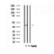 DF4921 staining COLO205 by IF/ICC. The sample were fixed with PFA and permeabilized in 0.1% Triton X-100,then blocked in 10% serum for 45 minutes at 25¡ãC. The primary antibody was diluted at 1/200 and incubated with the sample for 1 hour at 37¡ãC. An  Alexa Fluor 594 conjugated goat anti-rabbit IgG (H+L) Ab, diluted at 1/600, was used as the secondary antibod