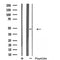 DF4922 staining Hela by IF/ICC. The sample were fixed with PFA and permeabilized in 0.1% Triton X-100,then blocked in 10% serum for 45 minutes at 25¡ãC. The primary antibody was diluted at 1/200 and incubated with the sample for 1 hour at 37¡ãC. An  Alexa Fluor 594 conjugated goat anti-rabbit IgG (H+L) Ab, diluted at 1/600, was used as the secondary antibod