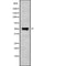 Western blot analysis of extracts from Hela, using EDNRA Antibody. Lane 1 was treated with the blocking peptide.