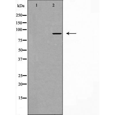 DF4924 staining COLO205 by IF/ICC. The sample were fixed with PFA and permeabilized in 0.1% Triton X-100,then blocked in 10% serum for 45 minutes at 25¡ãC. The primary antibody was diluted at 1/200 and incubated with the sample for 1 hour at 37¡ãC. An  Alexa Fluor 594 conjugated goat anti-rabbit IgG (H+L) Ab, diluted at 1/600, was used as the secondary antibod