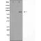 DF4924 staining COLO205 by IF/ICC. The sample were fixed with PFA and permeabilized in 0.1% Triton X-100,then blocked in 10% serum for 45 minutes at 25¡ãC. The primary antibody was diluted at 1/200 and incubated with the sample for 1 hour at 37¡ãC. An  Alexa Fluor 594 conjugated goat anti-rabbit IgG (H+L) Ab, diluted at 1/600, was used as the secondary antibod