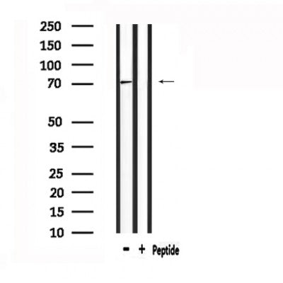 Western blot analysis of extracts from various samples, using FSHR Antibody.lane 1:Mouse brainlane 2:Hela