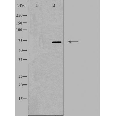 DF4928 staining HeLa by IF/ICC. The sample were fixed with PFA and permeabilized in 0.1% Triton X-100,then blocked in 10% serum for 45 minutes at 25¡ãC. The primary antibody was diluted at 1/200 and incubated with the sample for 1 hour at 37¡ãC. An  Alexa Fluor 594 conjugated goat anti-rabbit IgG (H+L) Ab, diluted at 1/600, was used as the secondary antibod