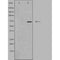 DF4928 staining HeLa by IF/ICC. The sample were fixed with PFA and permeabilized in 0.1% Triton X-100,then blocked in 10% serum for 45 minutes at 25¡ãC. The primary antibody was diluted at 1/200 and incubated with the sample for 1 hour at 37¡ãC. An  Alexa Fluor 594 conjugated goat anti-rabbit IgG (H+L) Ab, diluted at 1/600, was used as the secondary antibod