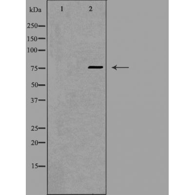 DF4929 staining A549 by IF/ICC. The sample were fixed with PFA and permeabilized in 0.1% Triton X-100,then blocked in 10% serum for 45 minutes at 25¡ãC. The primary antibody was diluted at 1/200 and incubated with the sample for 1 hour at 37¡ãC. An  Alexa Fluor 594 conjugated goat anti-rabbit IgG (H+L) Ab, diluted at 1/600, was used as the secondary antibod