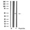 DF4936 staining LOVO by IF/ICC. The sample were fixed with PFA and permeabilized in 0.1% Triton X-100,then blocked in 10% serum for 45 minutes at 25¡ãC. The primary antibody was diluted at 1/200 and incubated with the sample for 1 hour at 37¡ãC. An  Alexa Fluor 594 conjugated goat anti-rabbit IgG (H+L) Ab, diluted at 1/600, was used as the secondary antibod