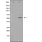 DF4937 staining  COLO205 cells by IF/ICC. The sample were fixed with PFA and permeabilized in 0.1% Triton X-100,then blocked in 10% serum for 45 minutes at 25¡ãC. The primary antibody was diluted at 1/200 and incubated with the sample for 1 hour at 37¡ãC. An  Alexa Fluor 594 conjugated goat anti-rabbit IgG (H+L) antibody(Cat.# S0006), diluted at 1/600, was used as secondary antibod