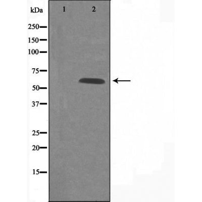 DF4938 staining Hela by IF/ICC. The sample were fixed with PFA and permeabilized in 0.1% Triton X-100,then blocked in 10% serum for 45 minutes at 25¡ãC. The primary antibody was diluted at 1/200 and incubated with the sample for 1 hour at 37¡ãC. An  Alexa Fluor 594 conjugated goat anti-rabbit IgG (H+L) Ab, diluted at 1/600, was used as the secondary antibod