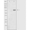 DF4943 staining RAW264.7 by IF/ICC. The sample were fixed with PFA and permeabilized in 0.1% Triton X-100,then blocked in 10% serum for 45 minutes at 25¡ãC. The primary antibody was diluted at 1/200 and incubated with the sample for 1 hour at 37¡ãC. An  Alexa Fluor 594 conjugated goat anti-rabbit IgG (H+L) Ab, diluted at 1/600, was used as the secondary antibod