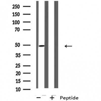 DF4949 staining Hela cells by IF/ICC. The sample were fixed with PFA and permeabilized in 0.1% Triton X-100,then blocked in 10% serum for 45 minutes at 25¡ãC. The primary antibody was diluted at 1/200 and incubated with the sample for 1 hour at 37¡ãC. An  Alexa Fluor 594 conjugated goat anti-rabbit IgG (H+L) antibody(Cat.# S0006), diluted at 1/600, was used as secondary antibod