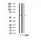 DF4954 staining Hela by IF/ICC. The sample were fixed with PFA and permeabilized in 0.1% Triton X-100,then blocked in 10% serum for 45 minutes at 25¡ãC. The primary antibody was diluted at 1/200 and incubated with the sample for 1 hour at 37¡ãC. An  Alexa Fluor 594 conjugated goat anti-rabbit IgG (H+L) Ab, diluted at 1/600, was used as the secondary antibod