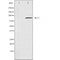 DF4955 staining 293 by IF/ICC. The sample were fixed with PFA and permeabilized in 0.1% Triton X-100,then blocked in 10% serum for 45 minutes at 25¡ãC. The primary antibody was diluted at 1/200 and incubated with the sample for 1 hour at 37¡ãC. An  Alexa Fluor 594 conjugated goat anti-rabbit IgG (H+L) Ab, diluted at 1/600, was used as the secondary antibod