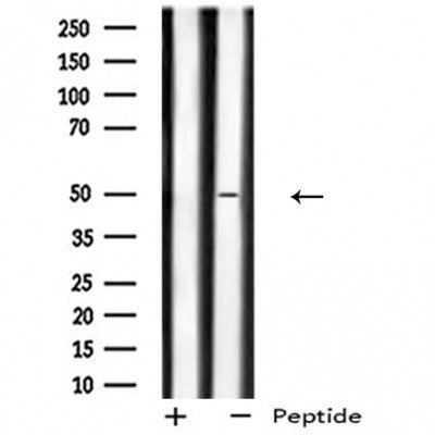 DF4961 at 1/100 staining Mouse liver tissue by IHC-P. The sample was formaldehyde fixed and a heat mediated antigen retrieval step in citrate buffer was performed. The sample was then blocked and incubated with the antibody for 1.5 hours at 22¡ãC. An HRP conjugated goat anti-rabbit antibody was used as the secondary