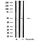 DF4961 at 1/100 staining Mouse liver tissue by IHC-P. The sample was formaldehyde fixed and a heat mediated antigen retrieval step in citrate buffer was performed. The sample was then blocked and incubated with the antibody for 1.5 hours at 22¡ãC. An HRP conjugated goat anti-rabbit antibody was used as the secondary