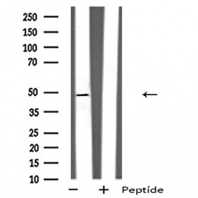 DF4962 staining  Hela cells by IF/ICC. The sample were fixed with PFA and permeabilized in 0.1% Triton X-100,then blocked in 10% serum for 45 minutes at 25¡ãC. The primary antibody was diluted at 1/200 and incubated with the sample for 1 hour at 37¡ãC. An  Alexa Fluor 594 conjugated goat anti-rabbit IgG (H+L) antibody(Cat.# S0006), diluted at 1/600, was used as secondary antibod