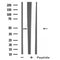 DF4962 staining  Hela cells by IF/ICC. The sample were fixed with PFA and permeabilized in 0.1% Triton X-100,then blocked in 10% serum for 45 minutes at 25¡ãC. The primary antibody was diluted at 1/200 and incubated with the sample for 1 hour at 37¡ãC. An  Alexa Fluor 594 conjugated goat anti-rabbit IgG (H+L) antibody(Cat.# S0006), diluted at 1/600, was used as secondary antibod
