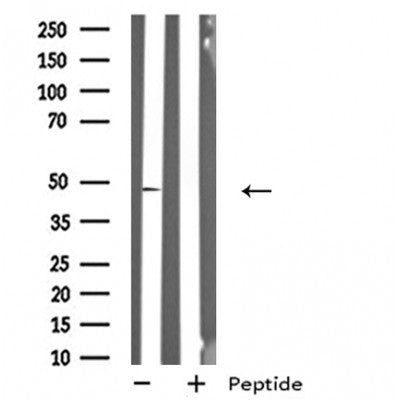 Western blot analysis of extracts from HeLa cells, using GPR19 antibody.