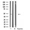 Western blot analysis of extracts from HeLa cells, using GPR19 antibody.