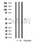 DF4981 staining COLO205 by IF/ICC. The sample were fixed with PFA and permeabilized in 0.1% Triton X-100,then blocked in 10% serum for 45 minutes at 25¡ãC. The primary antibody was diluted at 1/200 and incubated with the sample for 1 hour at 37¡ãC. An  Alexa Fluor 594 conjugated goat anti-rabbit IgG (H+L) Ab, diluted at 1/600, was used as the secondary antibod
