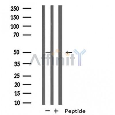 DF4981 staining COLO205 by IF/ICC. The sample were fixed with PFA and permeabilized in 0.1% Triton X-100,then blocked in 10% serum for 45 minutes at 25¡ãC. The primary antibody was diluted at 1/200 and incubated with the sample for 1 hour at 37¡ãC. An  Alexa Fluor 594 conjugated goat anti-rabbit IgG (H+L) Ab, diluted at 1/600, was used as the secondary antibod