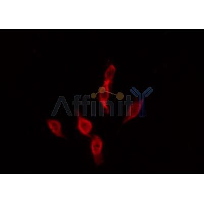 Western blot analysis of extracts from HepG2, using MC4R Antibody. Lane 1 was treated with the antigen-specific peptide.