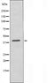 DF4985 staining Hela by IF/ICC. The sample were fixed with PFA and permeabilized in 0.1% Triton X-100,then blocked in 10% serum for 45 minutes at 25¡ãC. The primary antibody was diluted at 1/200 and incubated with the sample for 1 hour at 37¡ãC. An  Alexa Fluor 594 conjugated goat anti-rabbit IgG (H+L) Ab, diluted at 1/600, was used as the secondary antibod