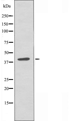 DF4986 staining HuvEc by IF/ICC. The sample were fixed with PFA and permeabilized in 0.1% Triton X-100,then blocked in 10% serum for 45 minutes at 25¡ãC. The primary antibody was diluted at 1/200 and incubated with the sample for 1 hour at 37¡ãC. An  Alexa Fluor 594 conjugated goat anti-rabbit IgG (H+L) Ab, diluted at 1/600, was used as the secondary antibod