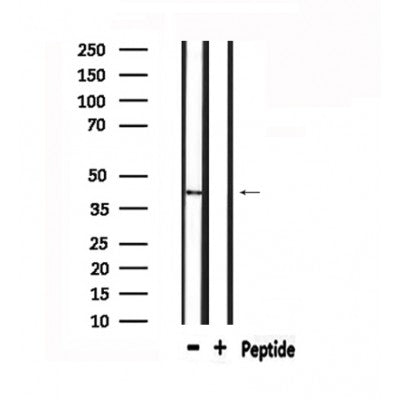 DF4988 staining HuvEc by IF/ICC. The sample were fixed with PFA and permeabilized in 0.1% Triton X-100,then blocked in 10% serum for 45 minutes at 25¡ãC. The primary antibody was diluted at 1/200 and incubated with the sample for 1 hour at 37¡ãC. An  Alexa Fluor 594 conjugated goat anti-rabbit IgG (H+L) Ab, diluted at 1/600, was used as the secondary antibod