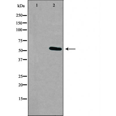 DF5149 staining Hela by IF/ICC. The sample were fixed with PFA and permeabilized in 0.1% Triton X-100,then blocked in 10% serum for 45 minutes at 25¡ãC. The primary antibody was diluted at 1/200 and incubated with the sample for 1 hour at 37¡ãC. An  Alexa Fluor 594 conjugated goat anti-rabbit IgG (H+L) Ab, diluted at 1/600, was used as the secondary antibod