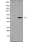DF5149 staining Hela by IF/ICC. The sample were fixed with PFA and permeabilized in 0.1% Triton X-100,then blocked in 10% serum for 45 minutes at 25¡ãC. The primary antibody was diluted at 1/200 and incubated with the sample for 1 hour at 37¡ãC. An  Alexa Fluor 594 conjugated goat anti-rabbit IgG (H+L) Ab, diluted at 1/600, was used as the secondary antibod