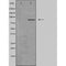 DF5150 staining Hela by IF/ICC. The sample were fixed with PFA and permeabilized in 0.1% Triton X-100,then blocked in 10% serum for 45 minutes at 25¡ãC. The primary antibody was diluted at 1/200 and incubated with the sample for 1 hour at 37¡ãC. An  Alexa Fluor 594 conjugated goat anti-rabbit IgG (H+L) Ab, diluted at 1/600, was used as the secondary antibod