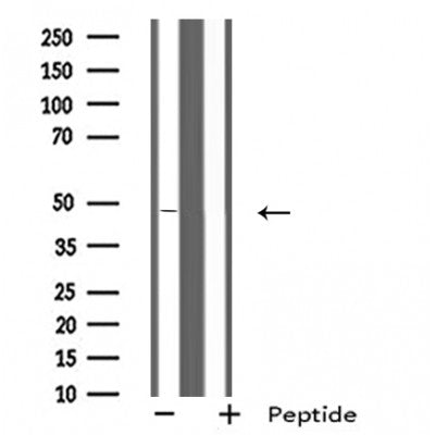 DF5151 staining HeLa cells by IF/ICC. The sample were fixed with PFA and permeabilized in 0.1% Triton X-100,then blocked in 10% serum for 45 minutes at 25¡ãC. The primary antibody was diluted at 1/200 and incubated with the sample for 1 hour at 37¡ãC. An  Alexa Fluor 594 conjugated goat anti-rabbit IgG (H+L) antibody(Cat.# S0006), diluted at 1/600, was used as secondary antibod