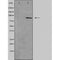 DF5152 staining HuvEc by IF/ICC. The sample were fixed with PFA and permeabilized in 0.1% Triton X-100,then blocked in 10% serum for 45 minutes at 25¡ãC. The primary antibody was diluted at 1/200 and incubated with the sample for 1 hour at 37¡ãC. An  Alexa Fluor 594 conjugated goat anti-rabbit IgG (H+L) Ab, diluted at 1/600, was used as the secondary antibod