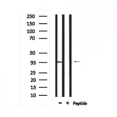 Western blot analysis of extracts from 293, using MSHR Antibody. Lane 1 was treated with the antigen-specific peptide.