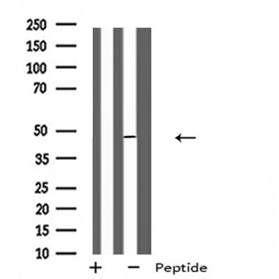 DF4993 staining HeLa by IF/ICC. The sample were fixed with PFA and permeabilized in 0.1% Triton X-100,then blocked in 10% serum for 45 minutes at 25¡ãC. The primary antibody was diluted at 1/200 and incubated with the sample for 1 hour at 37¡ãC. An  Alexa Fluor 594 conjugated goat anti-rabbit IgG (H+L) Ab, diluted at 1/600, was used as the secondary antibod