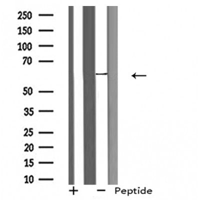DF4995 staining HeLa by IF/ICC. The sample were fixed with PFA and permeabilized in 0.1% Triton X-100,then blocked in 10% serum for 45 minutes at 25¡ãC. The primary antibody was diluted at 1/200 and incubated with the sample for 1 hour at 37¡ãC. An  Alexa Fluor 594 conjugated goat anti-rabbit IgG (H+L) Ab, diluted at 1/600, was used as the secondary antibod