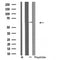DF4995 staining HeLa by IF/ICC. The sample were fixed with PFA and permeabilized in 0.1% Triton X-100,then blocked in 10% serum for 45 minutes at 25¡ãC. The primary antibody was diluted at 1/200 and incubated with the sample for 1 hour at 37¡ãC. An  Alexa Fluor 594 conjugated goat anti-rabbit IgG (H+L) Ab, diluted at 1/600, was used as the secondary antibod