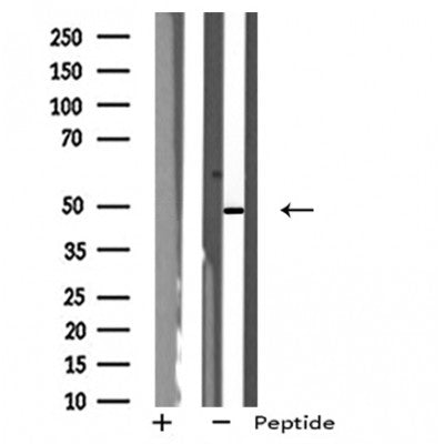 DF4999 staining NIH-3T3 by IF/ICC. The sample were fixed with PFA and permeabilized in 0.1% Triton X-100,then blocked in 10% serum for 45 minutes at 25¡ãC. The primary antibody was diluted at 1/200 and incubated with the sample for 1 hour at 37¡ãC. An  Alexa Fluor 594 conjugated goat anti-rabbit IgG (H+L) Ab, diluted at 1/600, was used as the secondary antibod