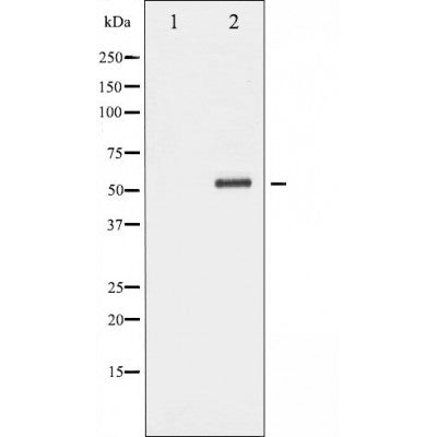 DF5000 staining HeLa cells by ICC/IF. Cells were fixed with PFA and permeabilized in 0.1% saponin prior to blocking in 10% serum for 45 minutes at 37¡ãC. The primary antibody was diluted 1/200 and incubated with the sample for 1 hour at 37¡ãC. A  Alexa Fluor 594 conjugated goat polyclonal to rabbit IgG (H+L), diluted 1/600 was used as secondary antibod