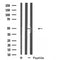 DF5001 at 1/100 staining Human liver cancer tissue by IHC-P. The sample was formaldehyde fixed and a heat mediated antigen retrieval step in citrate buffer was performed. The sample was then blocked and incubated with the antibody for 1.5 hours at 22¡ãC. An HRP conjugated goat anti-rabbit antibody was used as the secondary