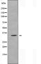 DF5016 staining MCF7 by IF/ICC. The sample were fixed with PFA and permeabilized in 0.1% Triton X-100,then blocked in 10% serum for 45 minutes at 25¡ãC. The primary antibody was diluted at 1/200 and incubated with the sample for 1 hour at 37¡ãC. An  Alexa Fluor 594 conjugated goat anti-rabbit IgG (H+L) Ab, diluted at 1/600, was used as the secondary antibod