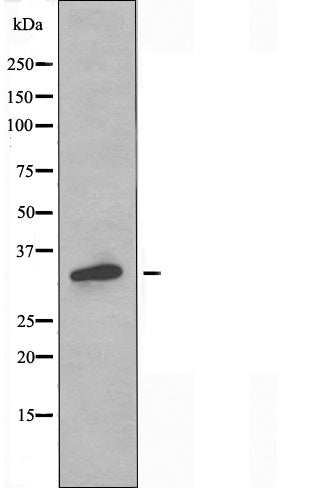 DF5018 staining HuvEc by IF/ICC. The sample were fixed with PFA and permeabilized in 0.1% Triton X-100,then blocked in 10% serum for 45 minutes at 25¡ãC. The primary antibody was diluted at 1/200 and incubated with the sample for 1 hour at 37¡ãC. An  Alexa Fluor 594 conjugated goat anti-rabbit IgG (H+L) Ab, diluted at 1/600, was used as the secondary antibod